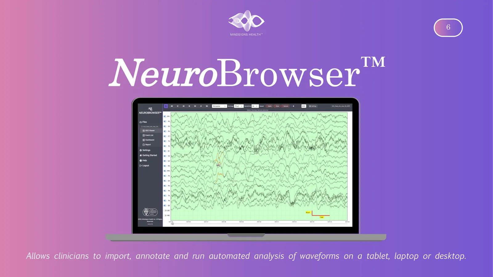 NeuroBrowser Allows clinicians to import, annotate and run automated analysis of waveforms on a tablet, laptop or desktop.